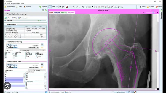 Screenshot OrthoView
