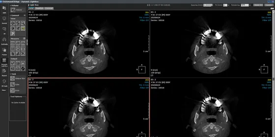 Screenshot ONDEMAND3D (Cybermed)
