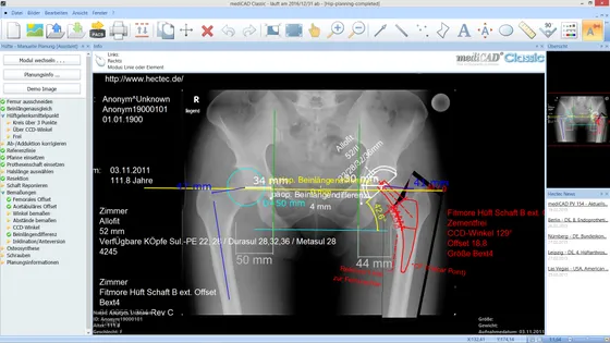Screenshot MediCAD