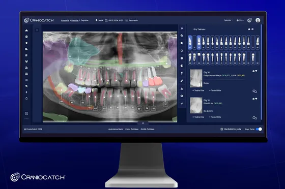 Screenshot CranioCatch Clinic