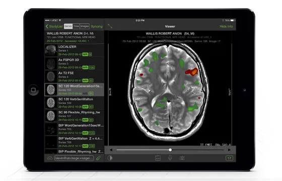 Screenshot Visage Imaging