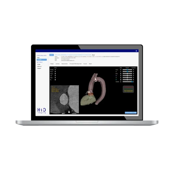 Screenshot Hi-D Imaging
