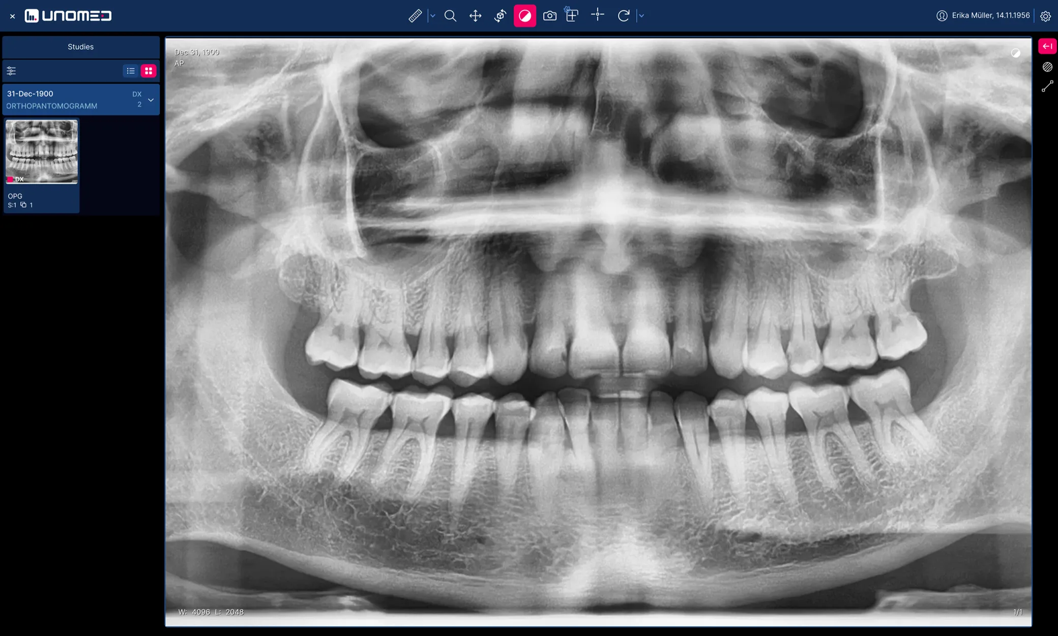 Unomed Cloud PACS im Browser: links die Studienliste mit einem Orthopantomogramm, rechts dieselbe Aufnahme im Viewer, darüber die Werkzeugleiste zum Messen, Verschieben und Fenstern.