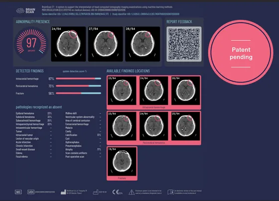 Screenshot Brainscan AI