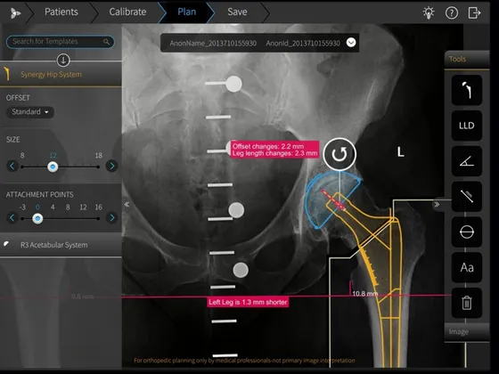 Screenshot TraumaCad