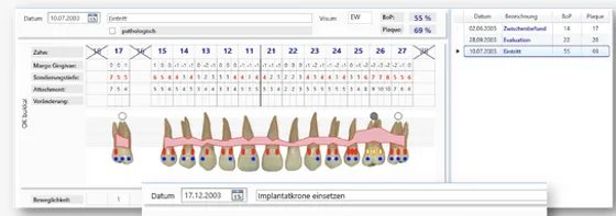 Screenshot dent II